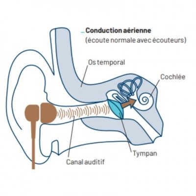 Casque audio conduction osseuse X-VIBES